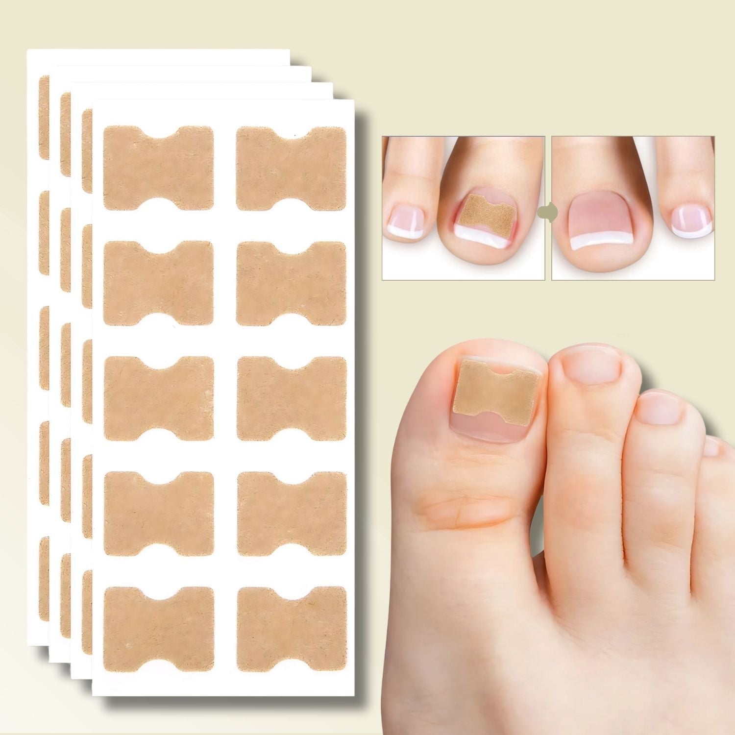 Instant Nail Repair Patches for Ingrown Nails – 10 Pack for Healthy Growth and Pain Relief
