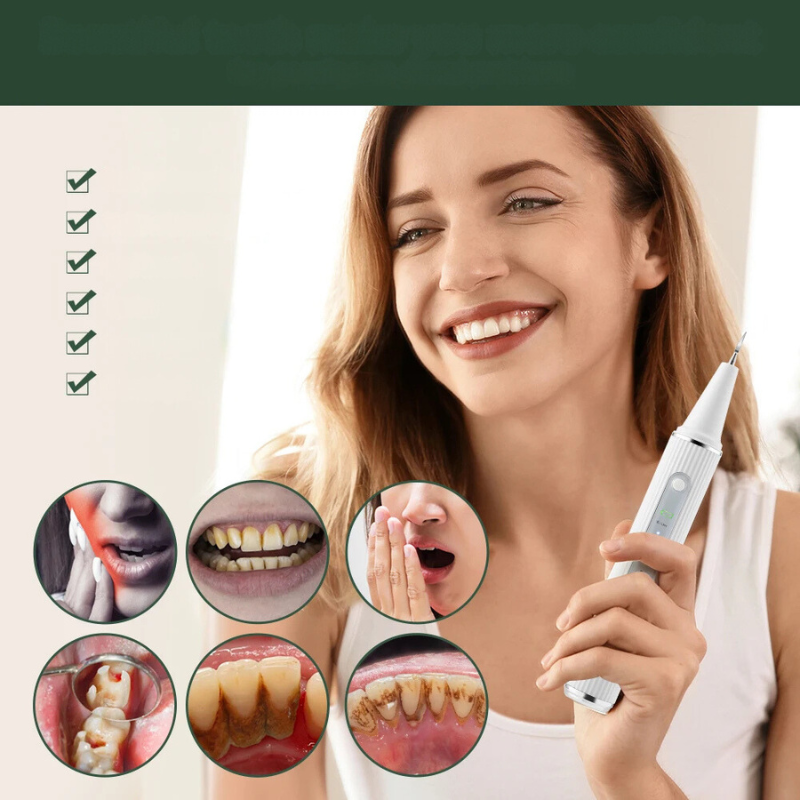 OrbitalScan Dental Tool – An ultrasonic dental cleaner that removes calculus with a professional-grade precision.